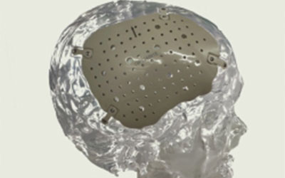 Ningbo Cibei Medical Equipment Co., Ltd.